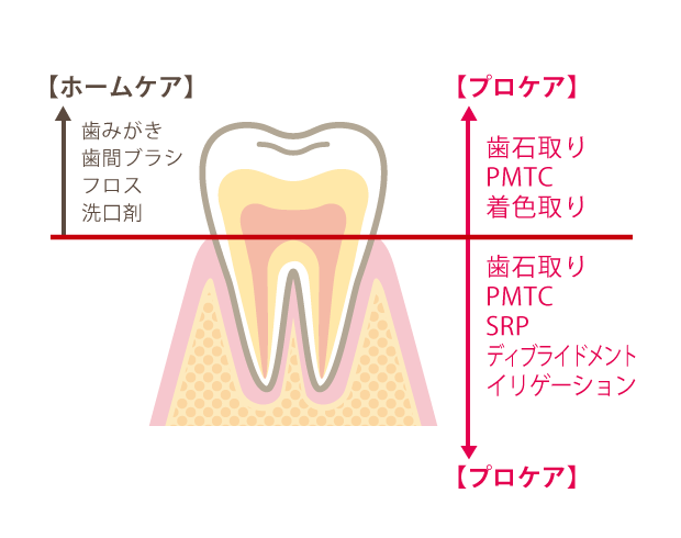 ホームケアではとりきれない部分に汚れが付くため